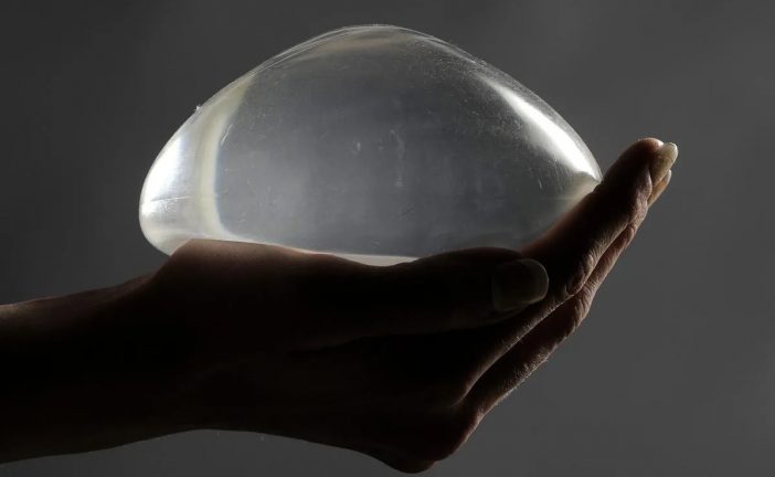 Canada’s mulling a national breast implant registry, years after a Star investigation revealed health risks